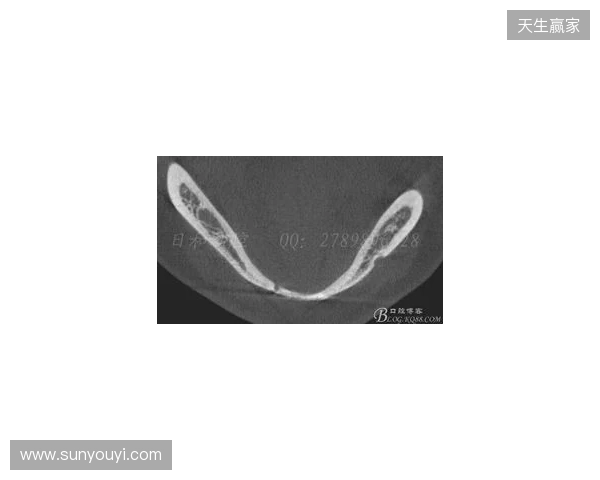 韦林顿确诊上唇部贯通伤；11、21牙半脱位；上颌前牙区牙槽骨骨折